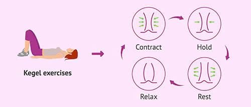 kỹ thuật của bài tập kegel cho nữ là gì